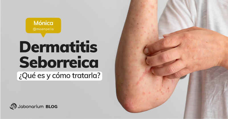 Dermatitis seborreica, es y tratarla