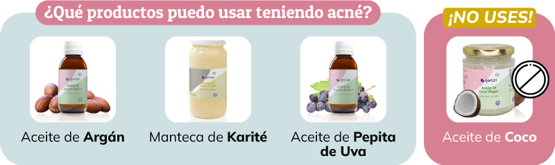 Qué aceites puedo usar teniendo acné